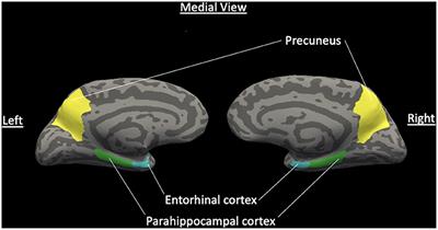 Cortical Thickness and Hippocampal Volume in Vascular and Non-vascular Depressed Patients